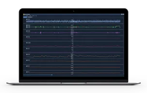 Mangold DataView software on a laptop computer